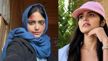 DGP Kashmir Movie: कश्मीर की वादियों में शुरू हुई फिल्म की शूटिंग, प्रज्ञा नयन का 'इंजर्ड लुक' सोशल मीडिया पर वायरल
